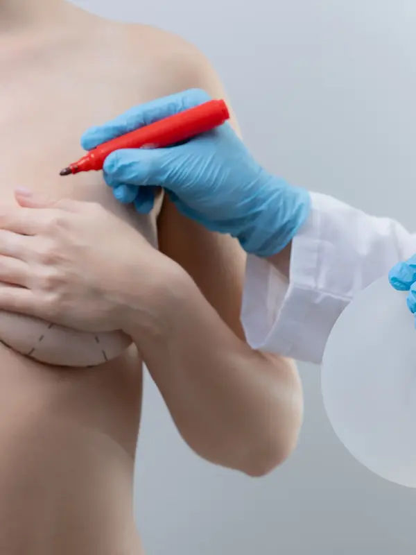Surgeon marking a patient's chest before surgery, holding a breast implant